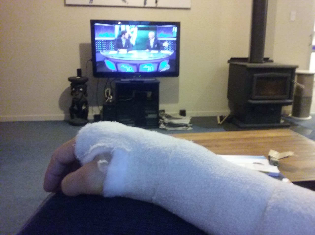 Resting up with the cast on